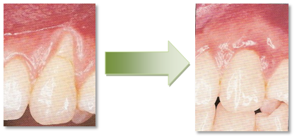dentysta Stargard stomatolog Stargard Dobry dentysta Stargard dobry stomatolog Stargard Szczeciński. Wybielanie zębów Stargard