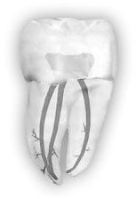 endodoncja stargard
