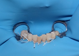 endodoncja stargard